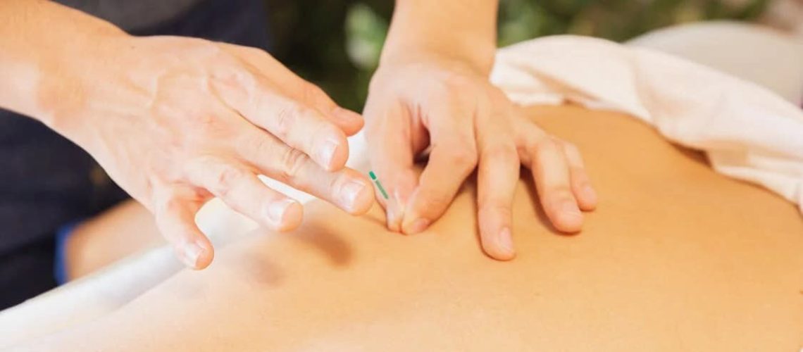 acupuncture-pain-relief